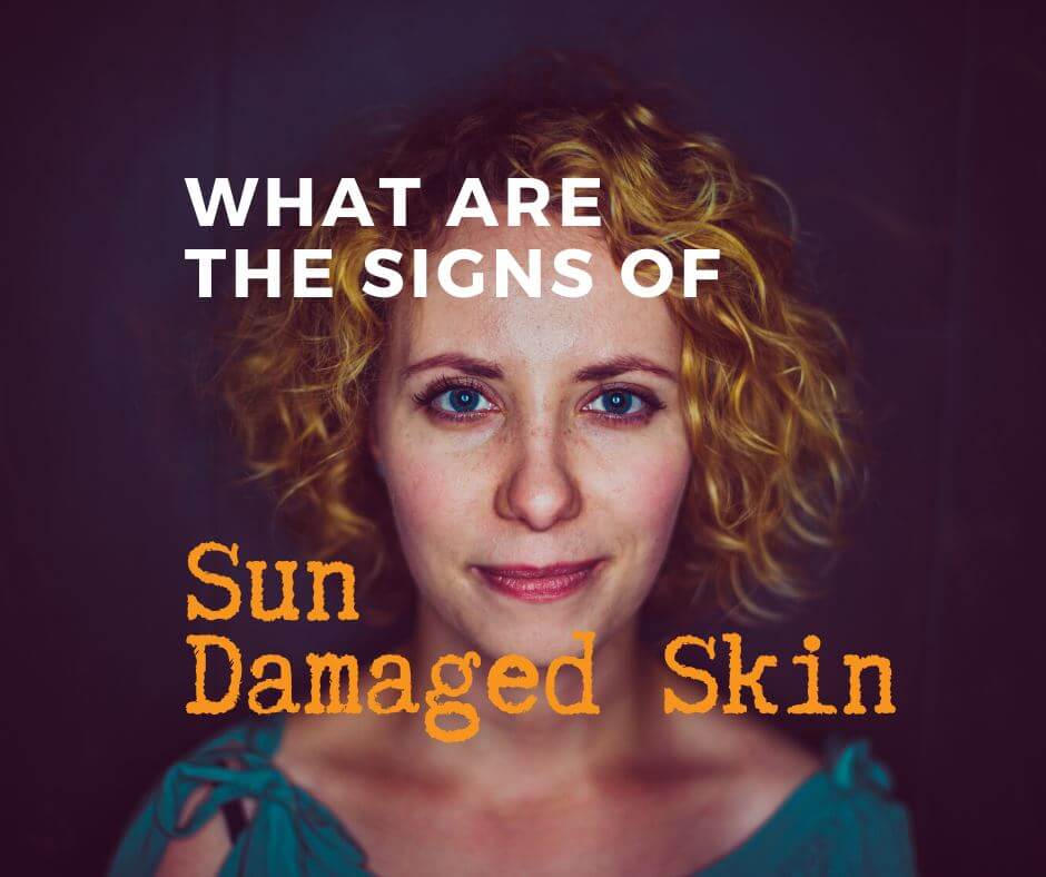 What are the signs of sun damaged skin?