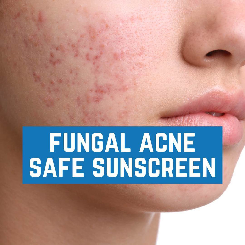 Fungal Acne Safe Sunscreen