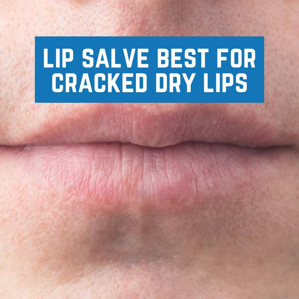 Lip Salve Best for Cracked Dry Lips