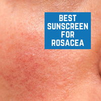 Best Sunscreen for Rosacea