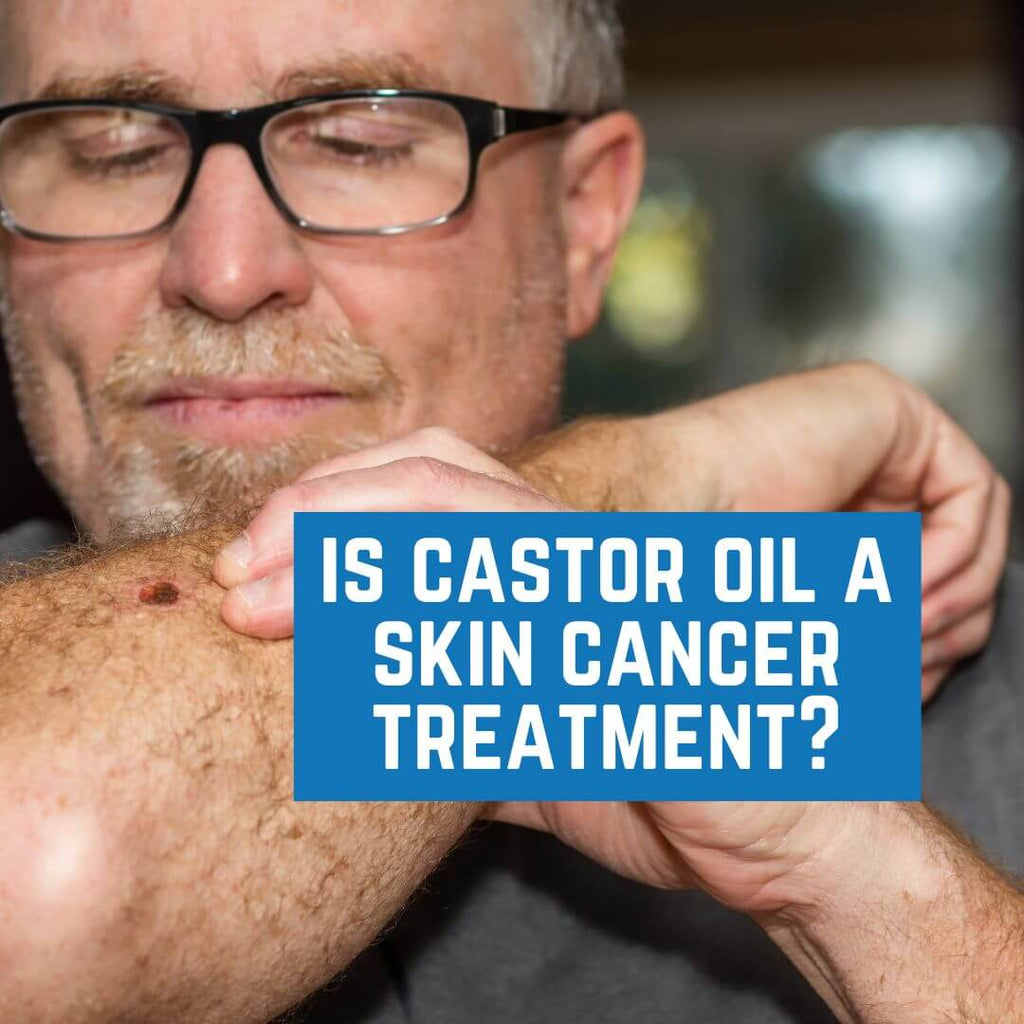 Is Castor Oil a Skin Cancer Treatment?