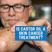 Is Castor Oil a Skin Cancer Treatment