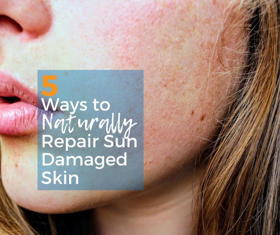 Naturally Repair Sun Damaged Skin