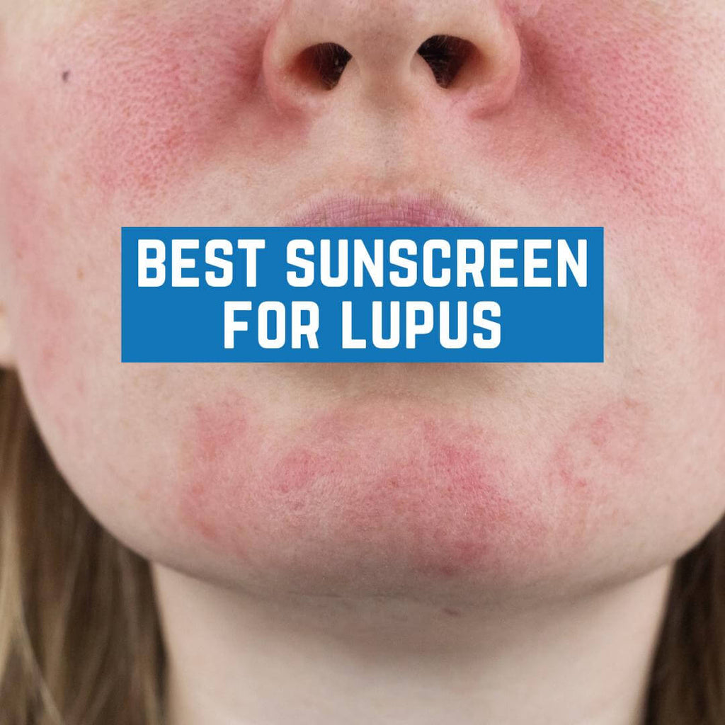Best Sunscreen for Lupus